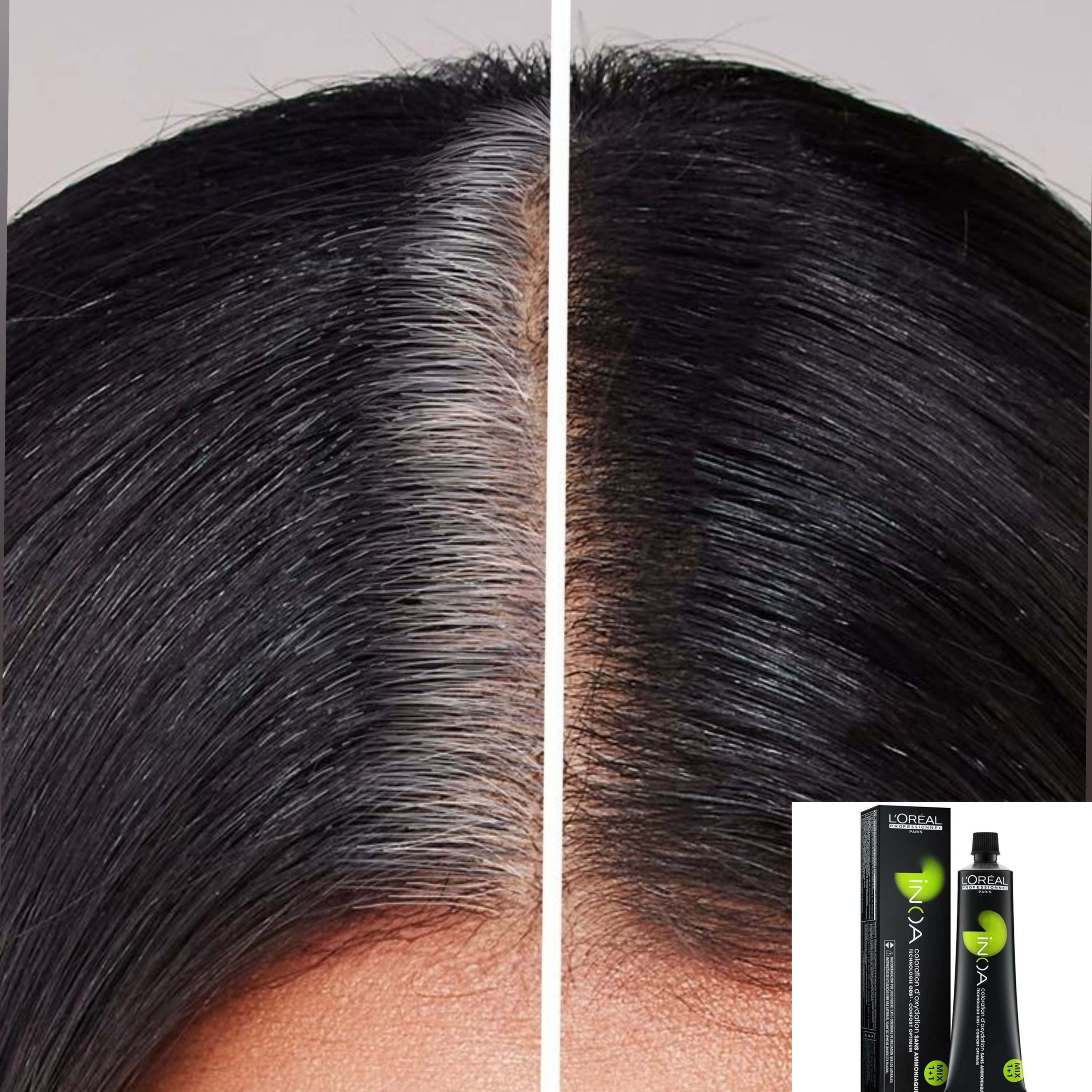 L'Oréal Inoa Root Fix