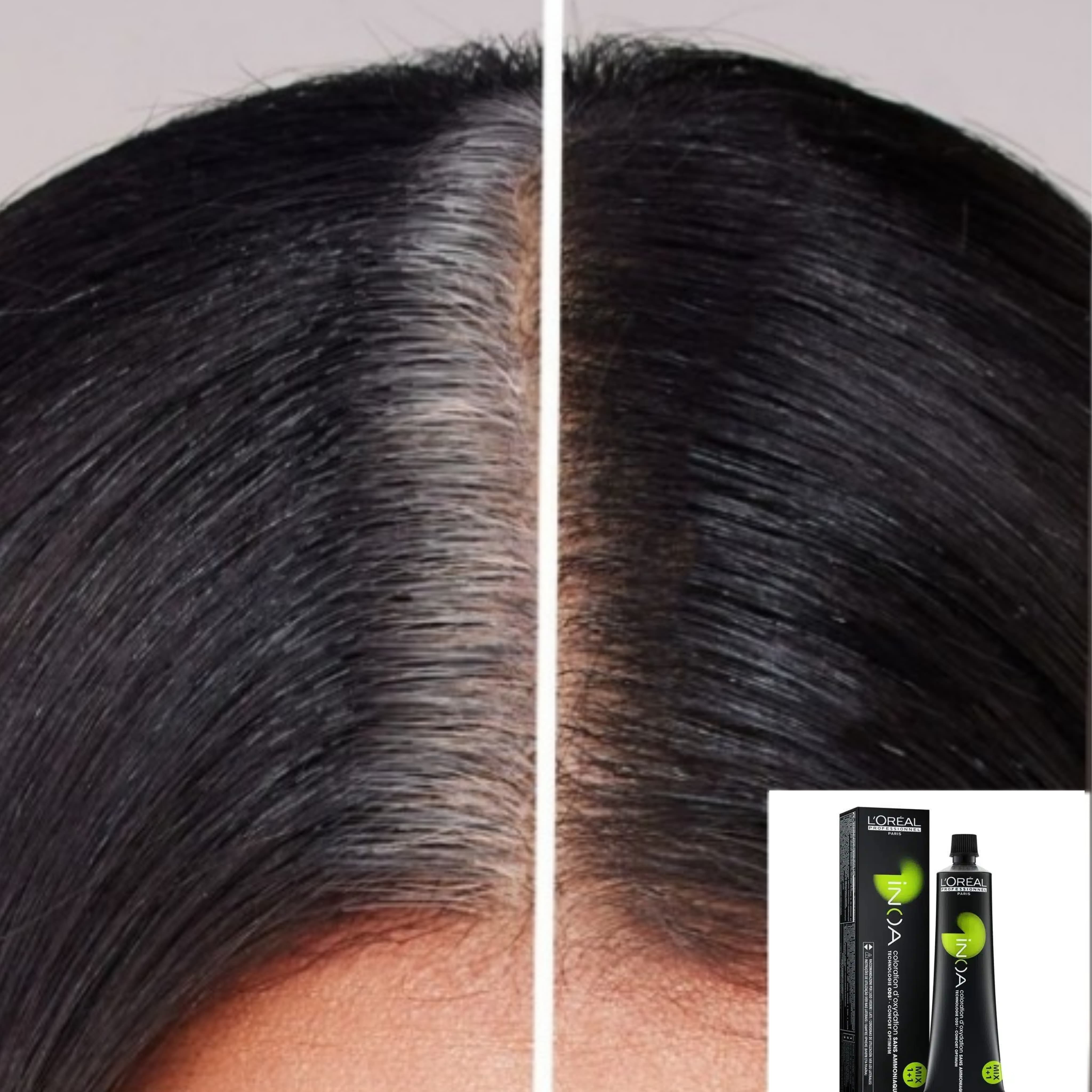 L'Oréal Inoa Root Fix